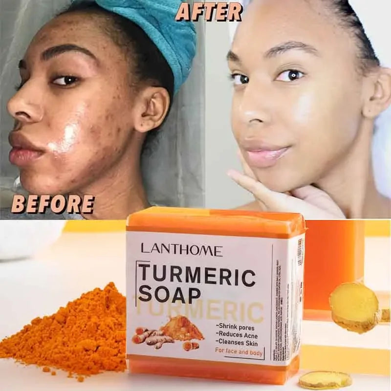 Turmeric Soap Face Cleansing Anti Acne